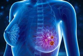BREAST-CANCER-Types-Symptoms-Risk-factors-Prevention-and-Treatment